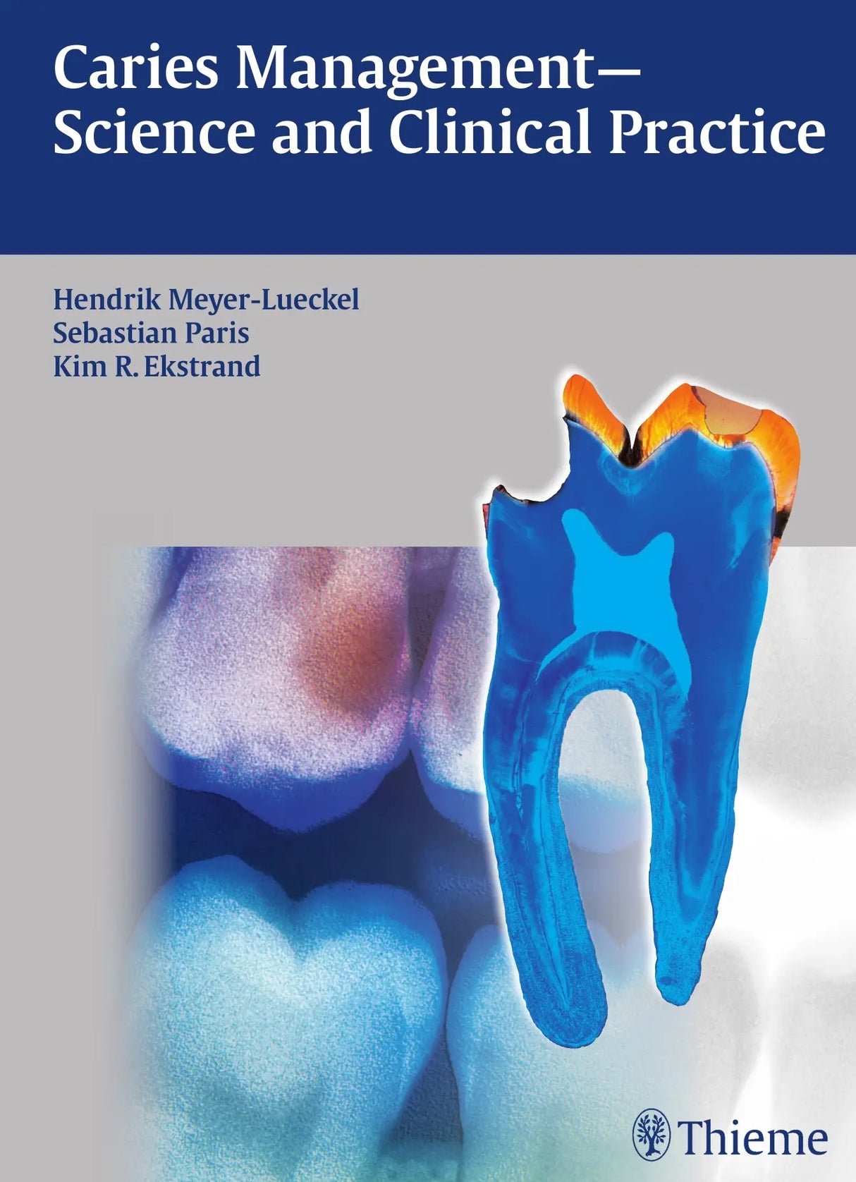Caries Management Science and Clinical Practice 2013