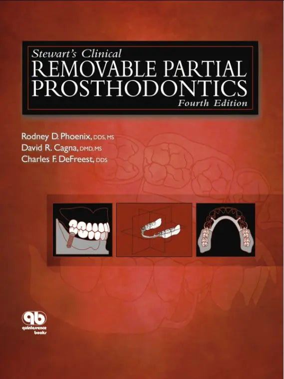 Stewart's Clinical Removable Partial Prosthodontics 2008
