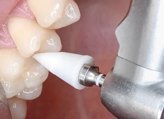 Shofu OneGloss Polisher Set