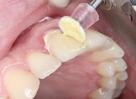 Shofu Super-Snap SuperBuff polishing Disk