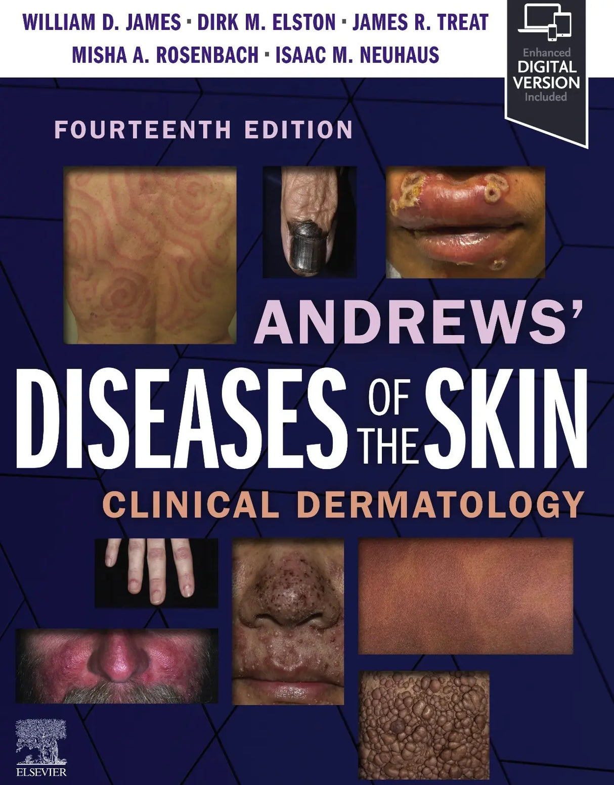 Andrews Diseases of the Skin Clinical Dermatology 2025