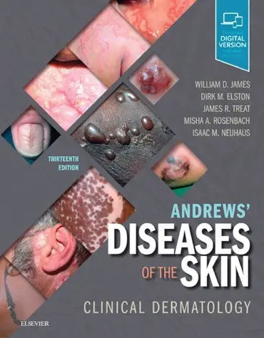 Andrews' Diseases of the Skin Clinical Dermatology 2020