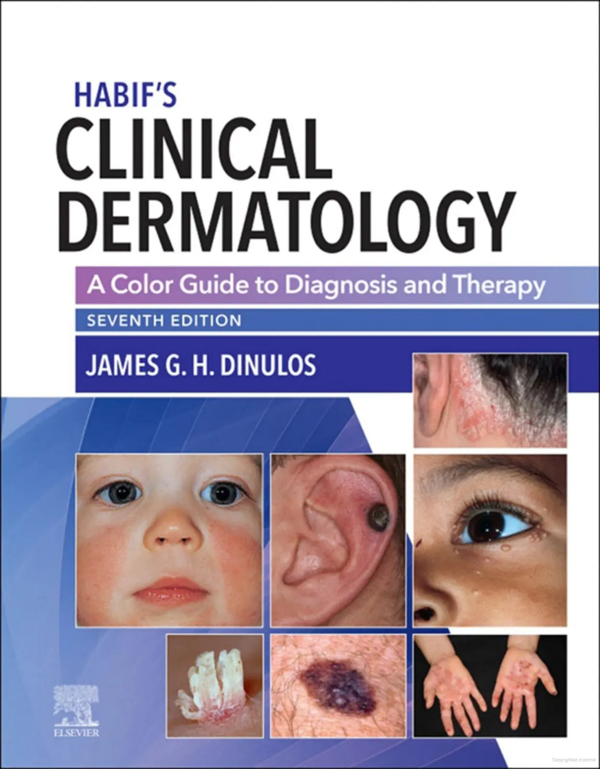 HABIF'S Clinical Dermatology 2021 A Color Guide to Diagnosis and Therapy