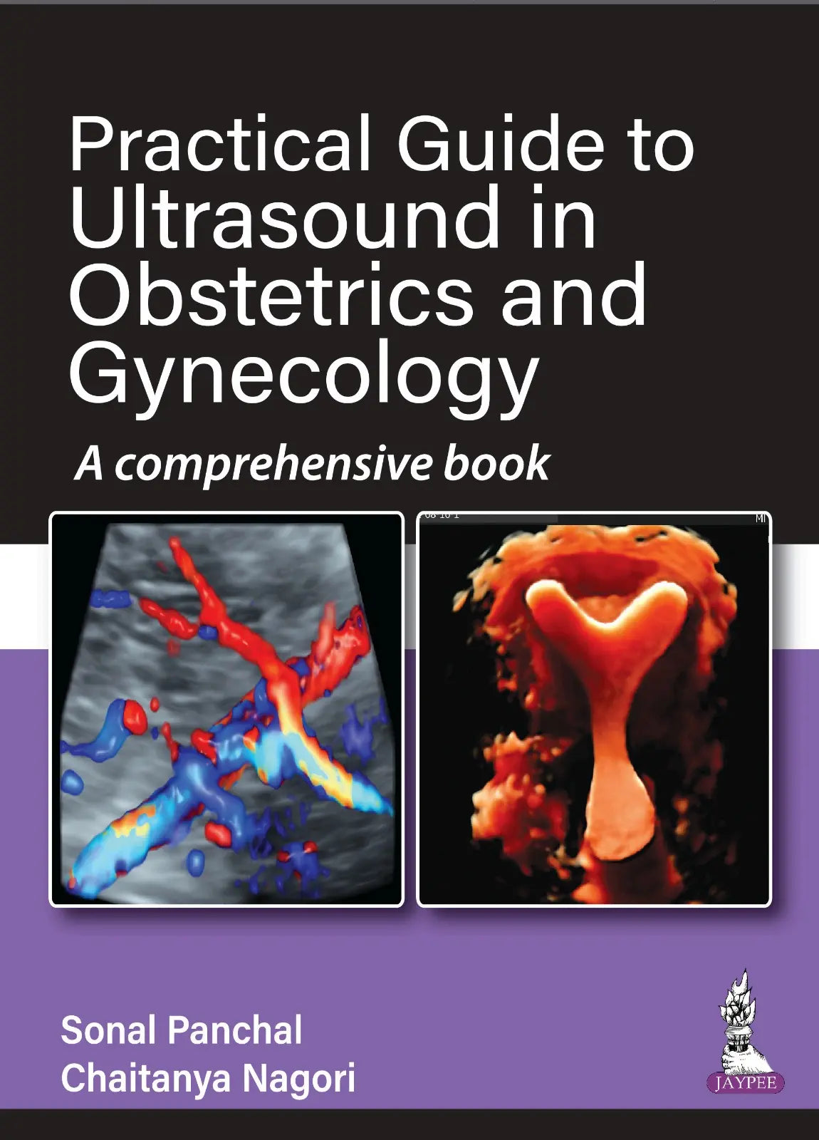 Practical Guide to Ultrasound in Obstetrics and Gynecology A Comprehensive Book  2022