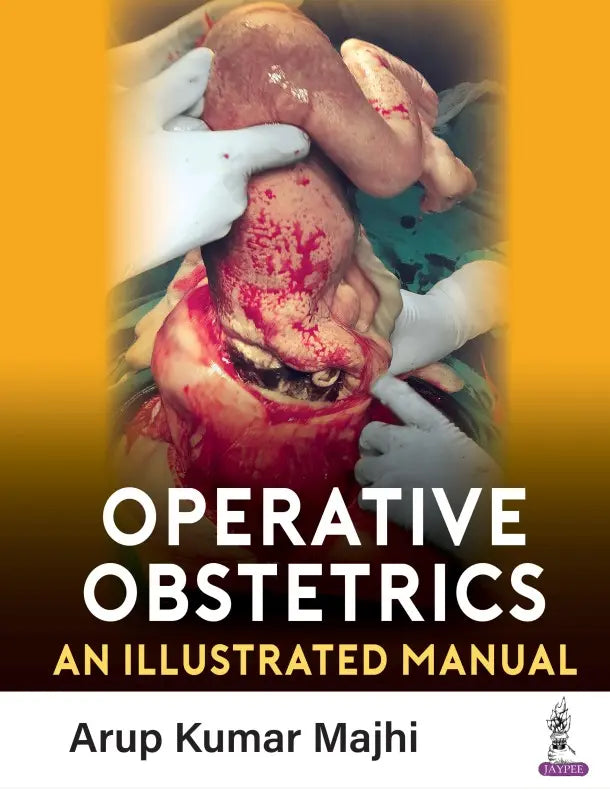 OPERATIVE OBSTETRICS An Illustrated Manual 2023