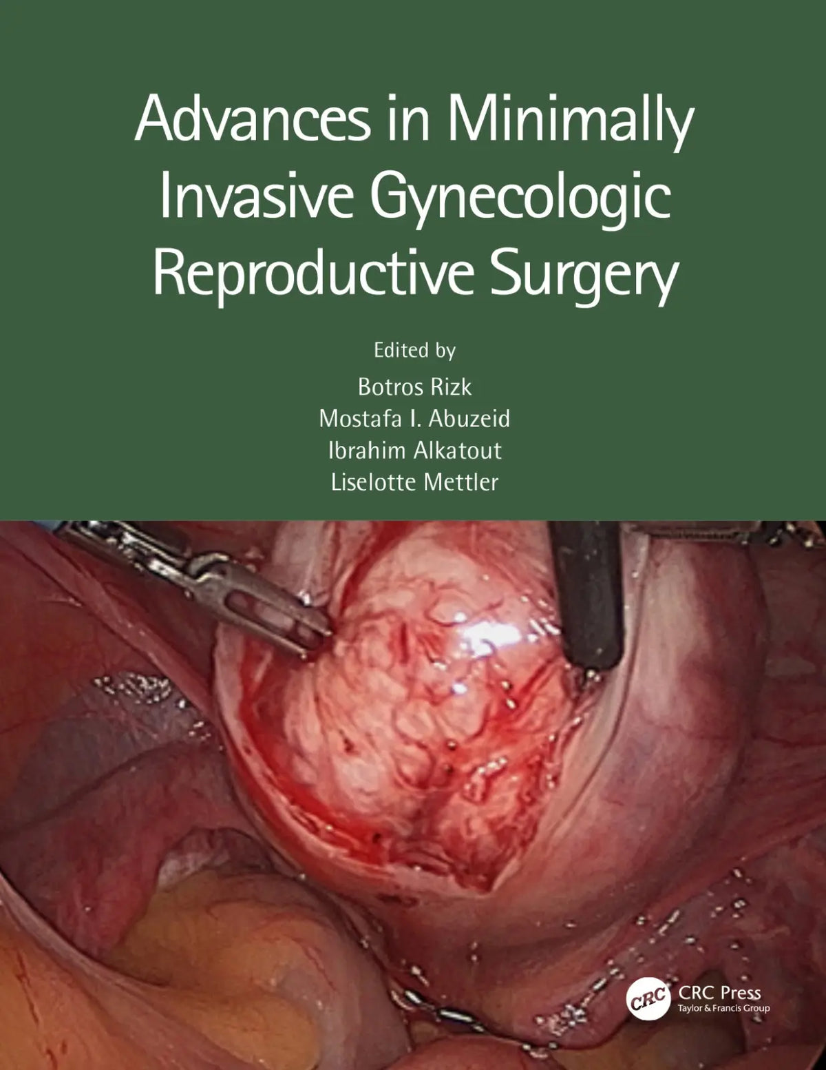 Advances In Minimally Invasive Gynecologic Reproductive Surgery 2022