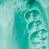 Zetalgin dust free dental alginate 453 g